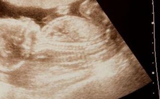 染色体异常去福建做三代试管婴儿可以吗？需要多少钱？