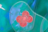 全面解析吉尔吉斯斯坦试管婴儿费用及其适合的人群