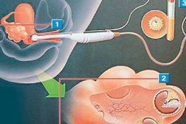 深圳能做三代试管婴儿的医院有哪些？